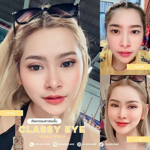 Classy Eye