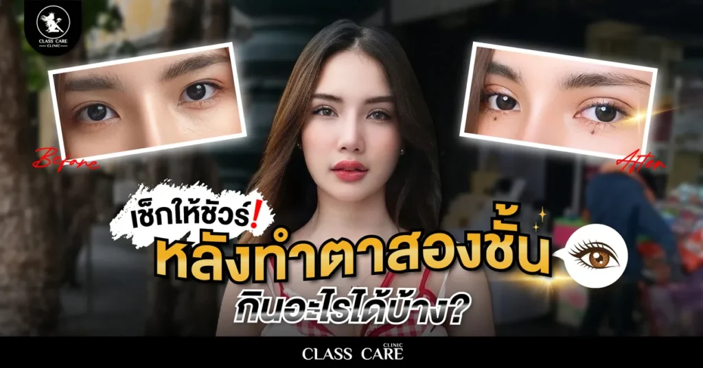 เช็กให้ชัวร์! หลังทำตาสองชั้นกินอะไรได้บ้าง