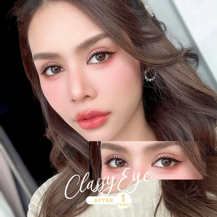 ตาสวยเรียบหรู หลังทำครบ 1 ปี