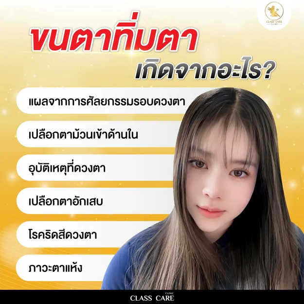 ขนตาทิ่มตาเกิดจากอะไร
