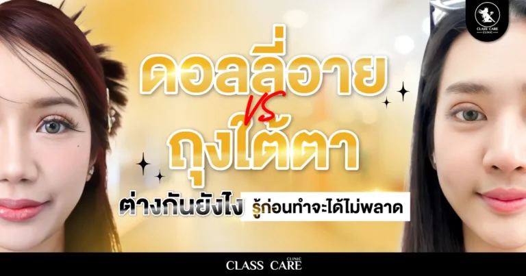 ดอลลี่อาย หรือ ถุงใต้ตา รู้วิธีเช็กง่าย ๆ จบใน 1 นาที
