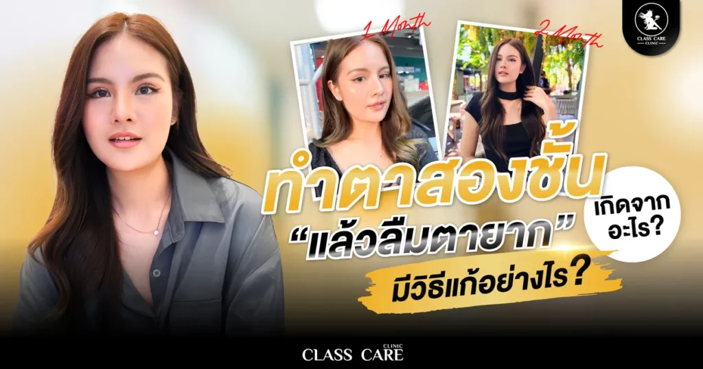 ลืมตาไม่ขึ้นหลังทำตา เกิดจากอะไร มีวิธีแก้ที่นี่