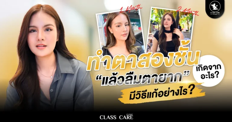 ลืมตาไม่ขึ้นหลังทำตา เกิดจากอะไร มีวิธีแก้ที่นี่
