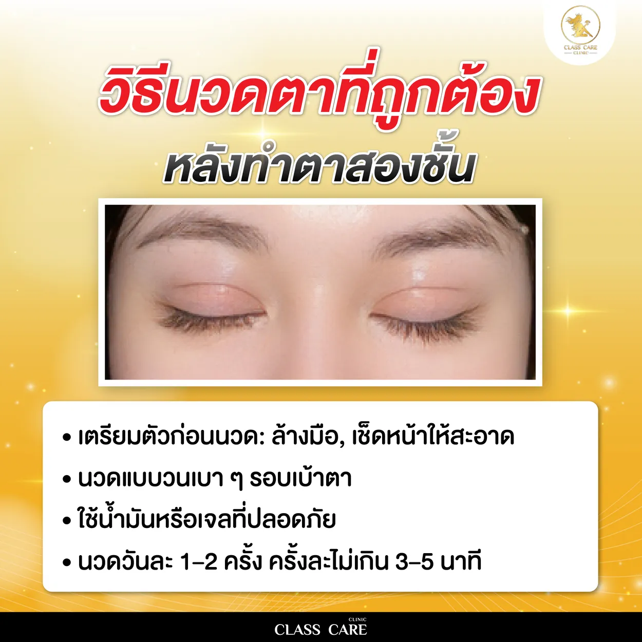 วิธีนวดตาที่ถูกต้องหลังทำตาสองชั้น