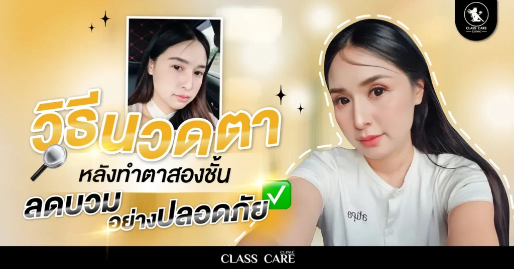 วิธีนวดตาหลังทำตาสองชั้นลดบวม อย่างปลอดภัย