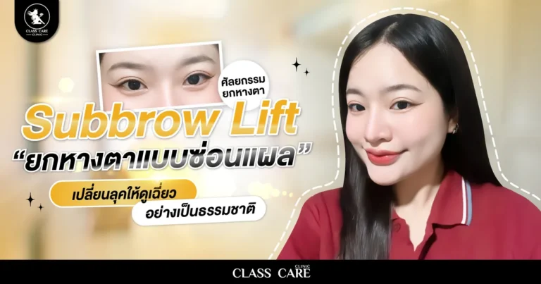 Subbrow Lift คืออะไร เทคนิคยกหางตา ซ่อนแผลใต้คิ้ว