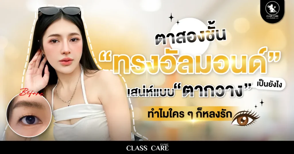 ตาสองชั้นทรงอัลมอนด์ เสน่ห์ดวงตาแบบกวาง