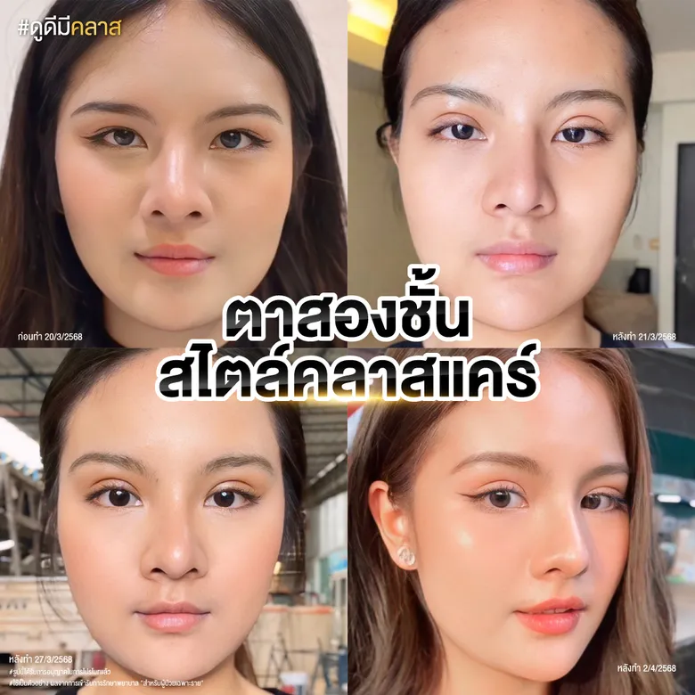 ตาสองชั้น สไตล์คลาสแคร์