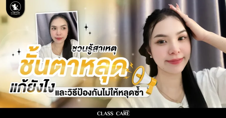 ชั้นตาหลุดแก้ยังไง ชวนรู้สาเหตุ และวิธีป้องกันไม่ให้หลุดซ้ำ