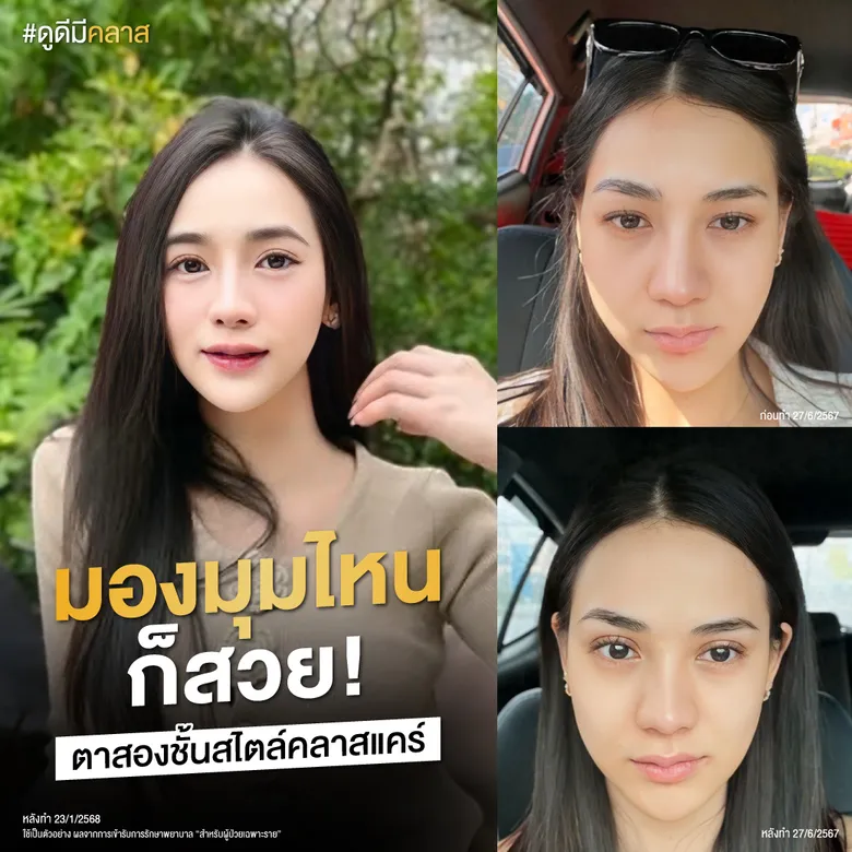 มองมุมไหนก็สวย! ตาสองชั้นสไตล์คลาสแคร์