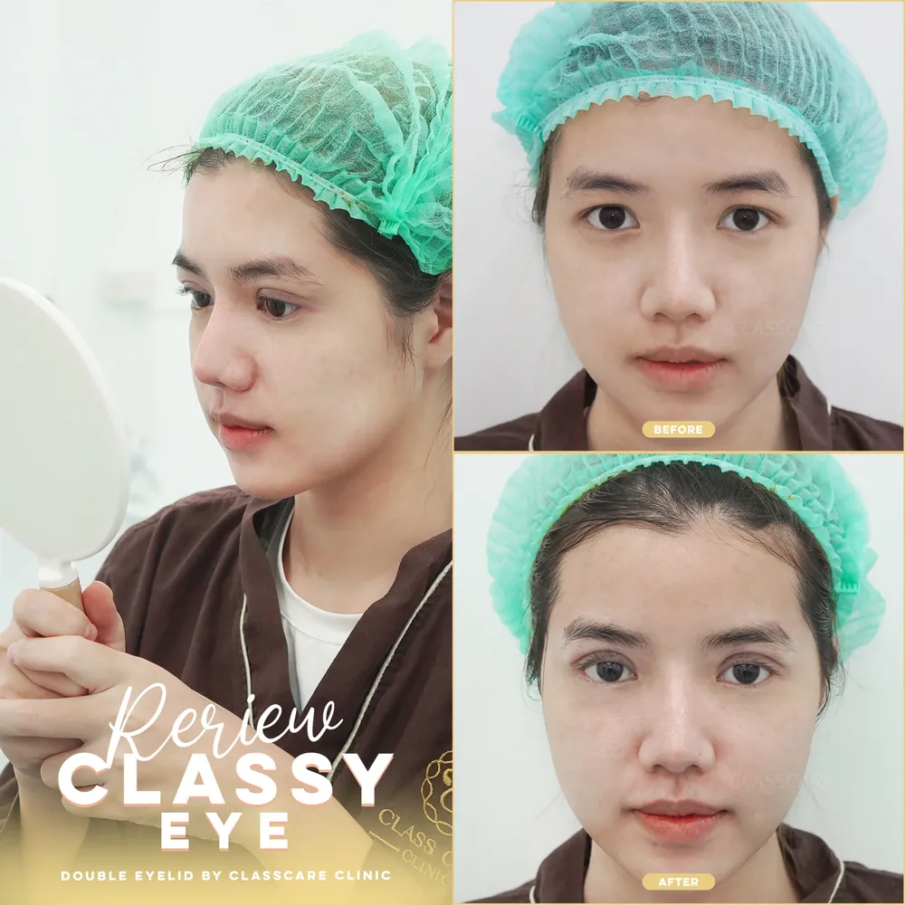 รีวิว: Classy Eye