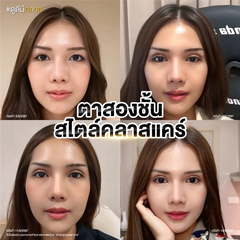 ตาสองชั้น สไตล์คลาสแคร์