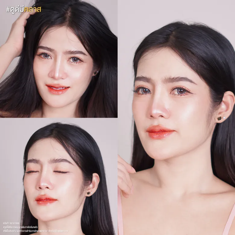การทำตาสองชั้นก่อนและหลัง