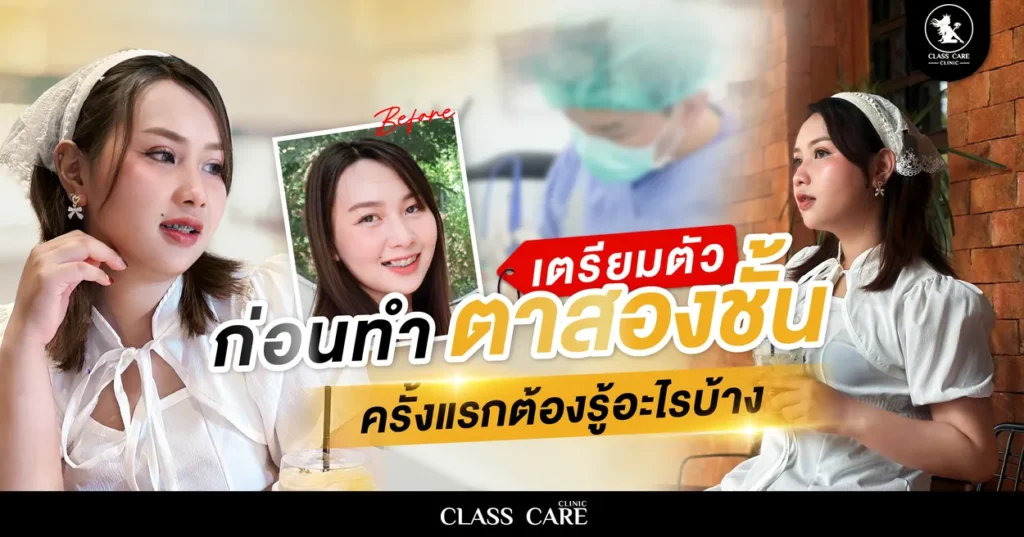 การเตรียมตัวก่อนทำตาครั้งแรกต้องรู้อะไรบ้าง