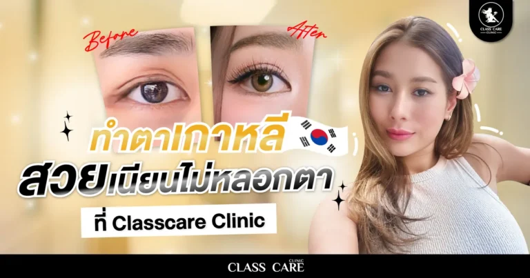 ทำตาเกาหลี สวยเนียน ไม่หลอกตา ที่ Classcare Clinic