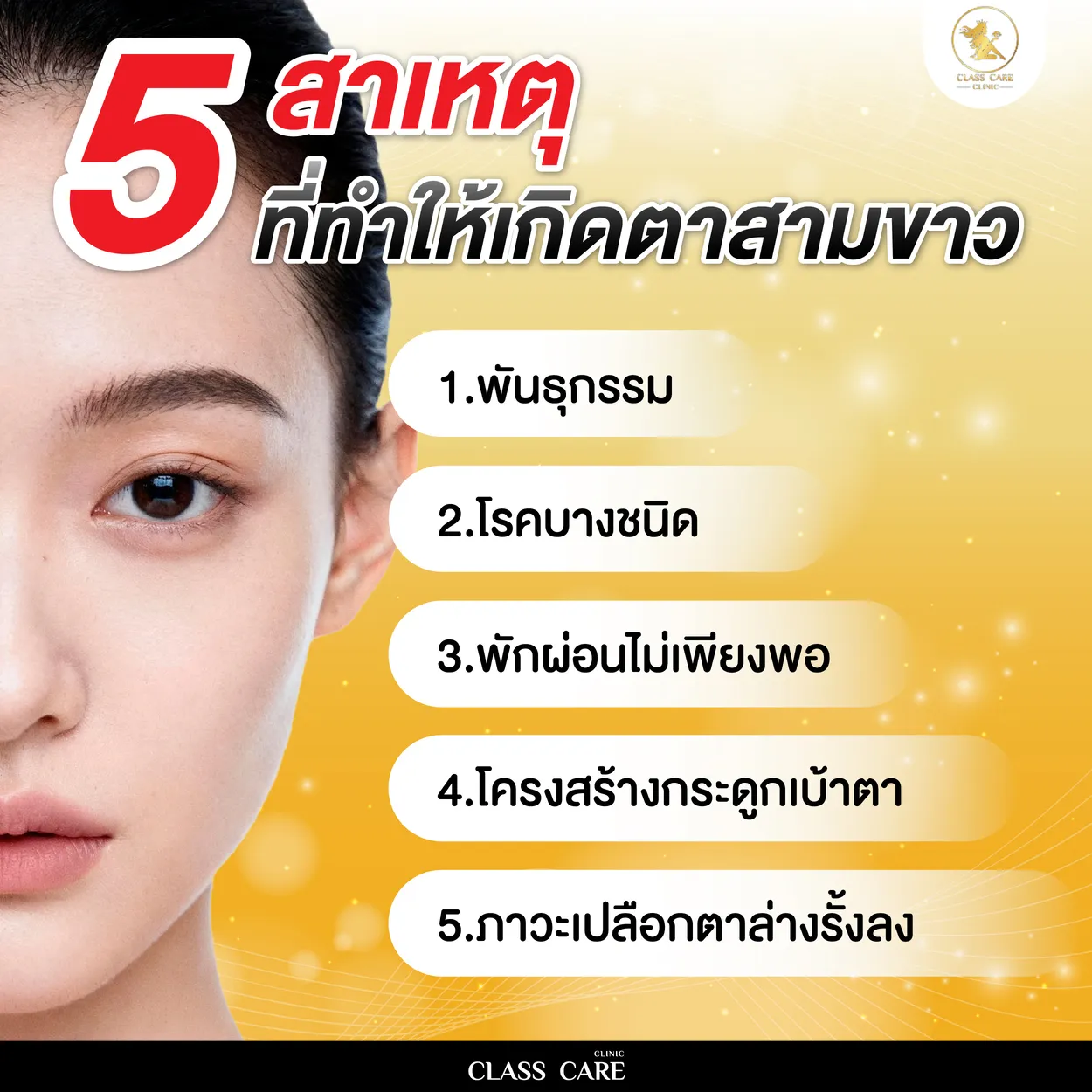 5 สาเหตุที่ทำให้เกิดตาสามขาว