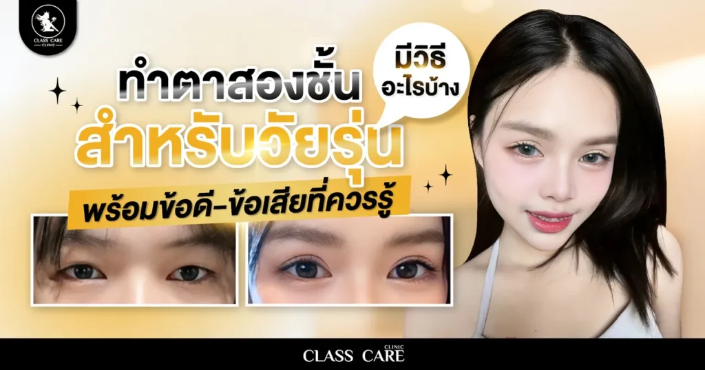 ทำตาสองชั้นสำหรับวัยรุ่น มีวิธีอะไรบ้าง พร้อมข้อดี-ข้อเสียที่ควรรู้