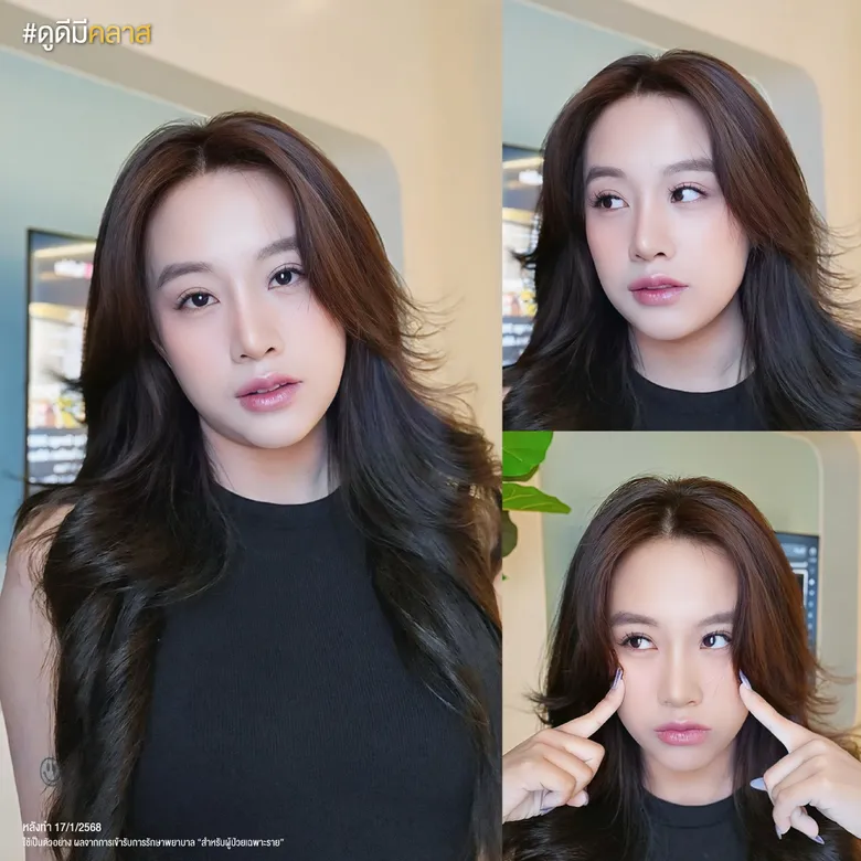 รีวิวการทำตาสองชั้นด้วยเทคนิคแผลเล็ก-02