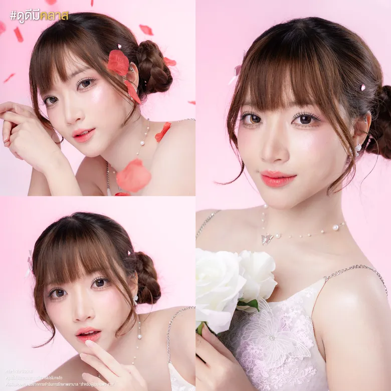 รีวิวการทำตาสองชั้นด้วยเทคนิคแผลเล็ก-03