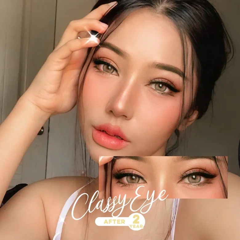 Classy Eye Result After 2 Years