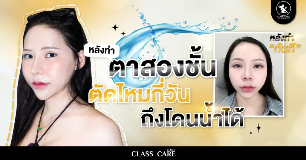 หลังทำตาสองชั้น ตัดไหมกี่วันโดนน้ำได้