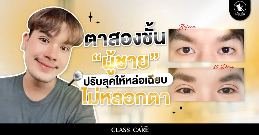 ทำตาสองชั้นผู้ชาย ปรับลุคให้หล่อเฉียบ ไม่หลอกตา