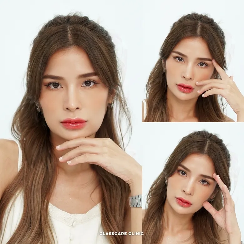 ผลลัพธ์ตาสองชั้นที่สวยงาม