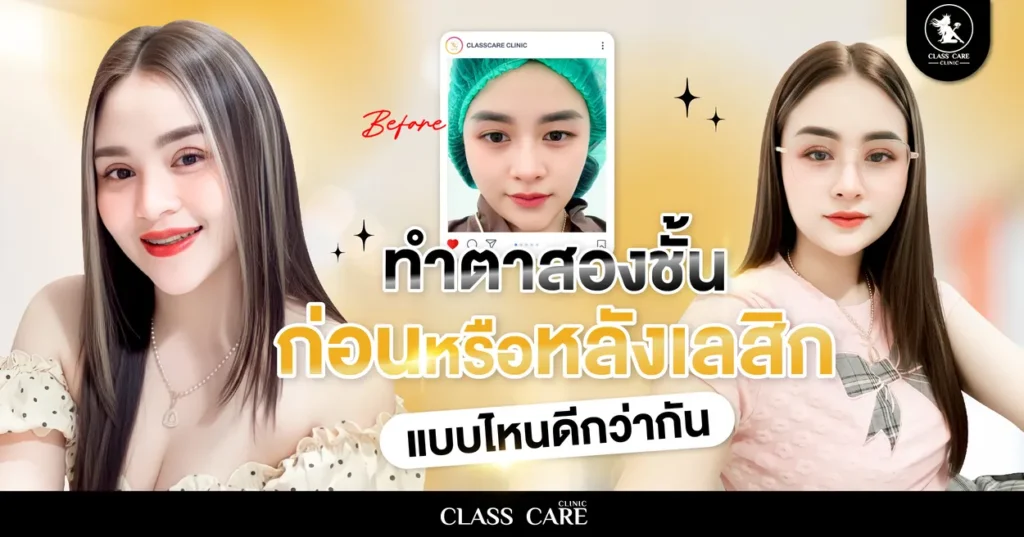 ตอบชัด ทำตาสองชั้นก่อนหรือหลังทำเลสิกดี