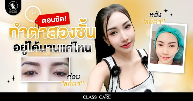 ทำตาสองชั้นอยู่ได้นานไหม และทำอย่างไรให้ชั้นตาสวยคงทน