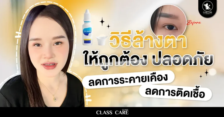 วิธีล้างตาที่ถูกต้อง ปลอดภัย ลดระคายเคืองและติดเชื้อ