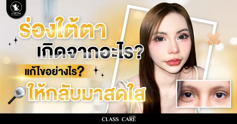 ร่องใต้ตาลึก เกิดจากอะไร แก้ไขอย่างไรให้กลับมาสดใส