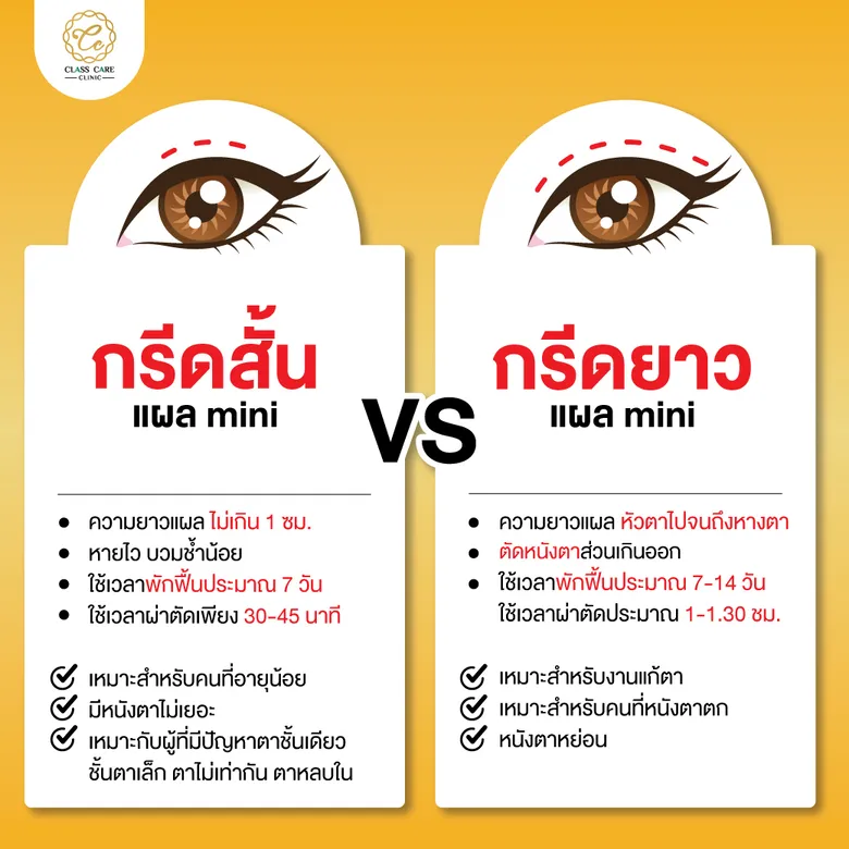เทียบชัด กรีดสั้น vs กรีดยาว