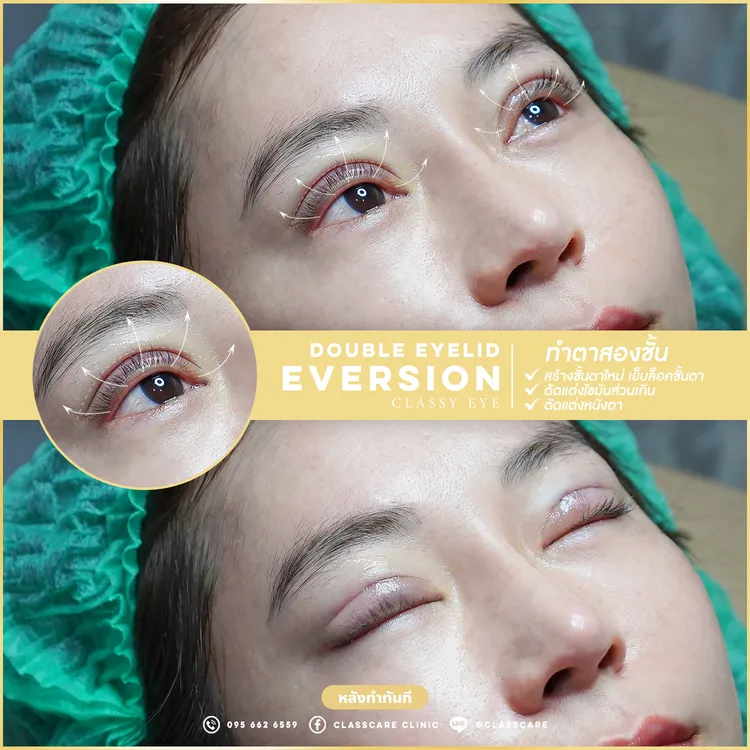 ชั้นตาชัด ล็อคเป๊ะ