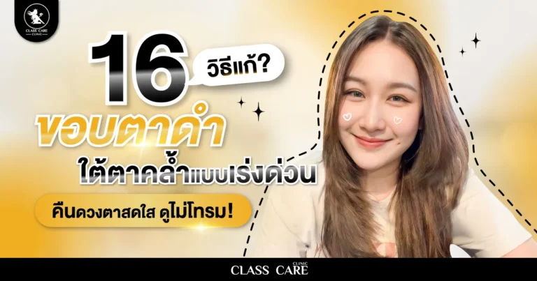 แชร์ 16 วิธีแก้ขอบตาดำ เร่งด่วนเพื่อคืนดวงตาสดใส ไม่ดูโทรม
