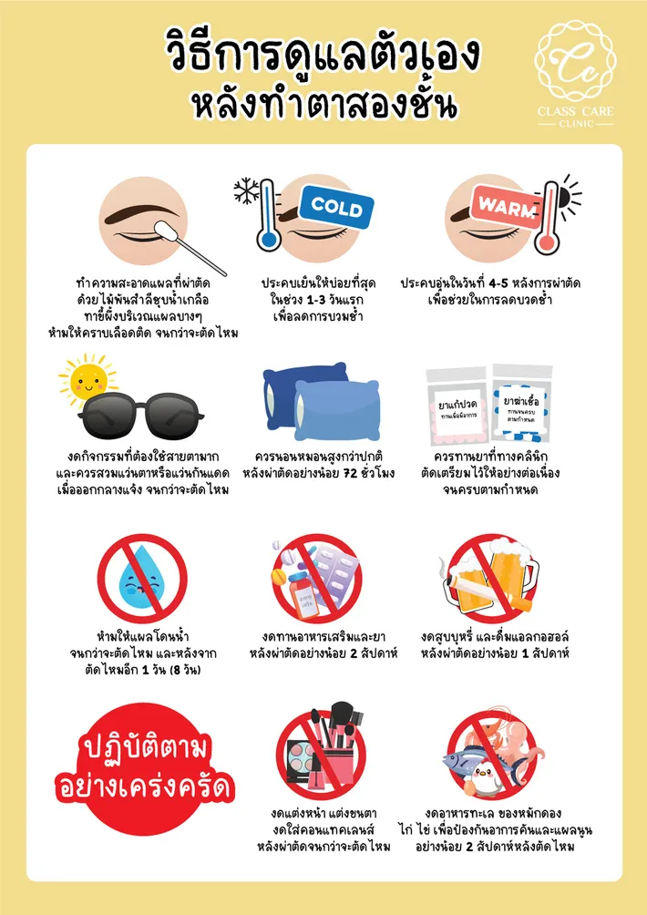 วิธีดูแลตัวเองหลังทำตาสองชั้น ให้แผลยุบไว หายบวมเร็วขึ้น