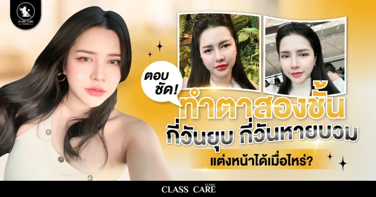 ทำตาสองชั้น กี่วันยุบ กี่วันหายบวม และแต่งหน้าได้เมื่อไหร่