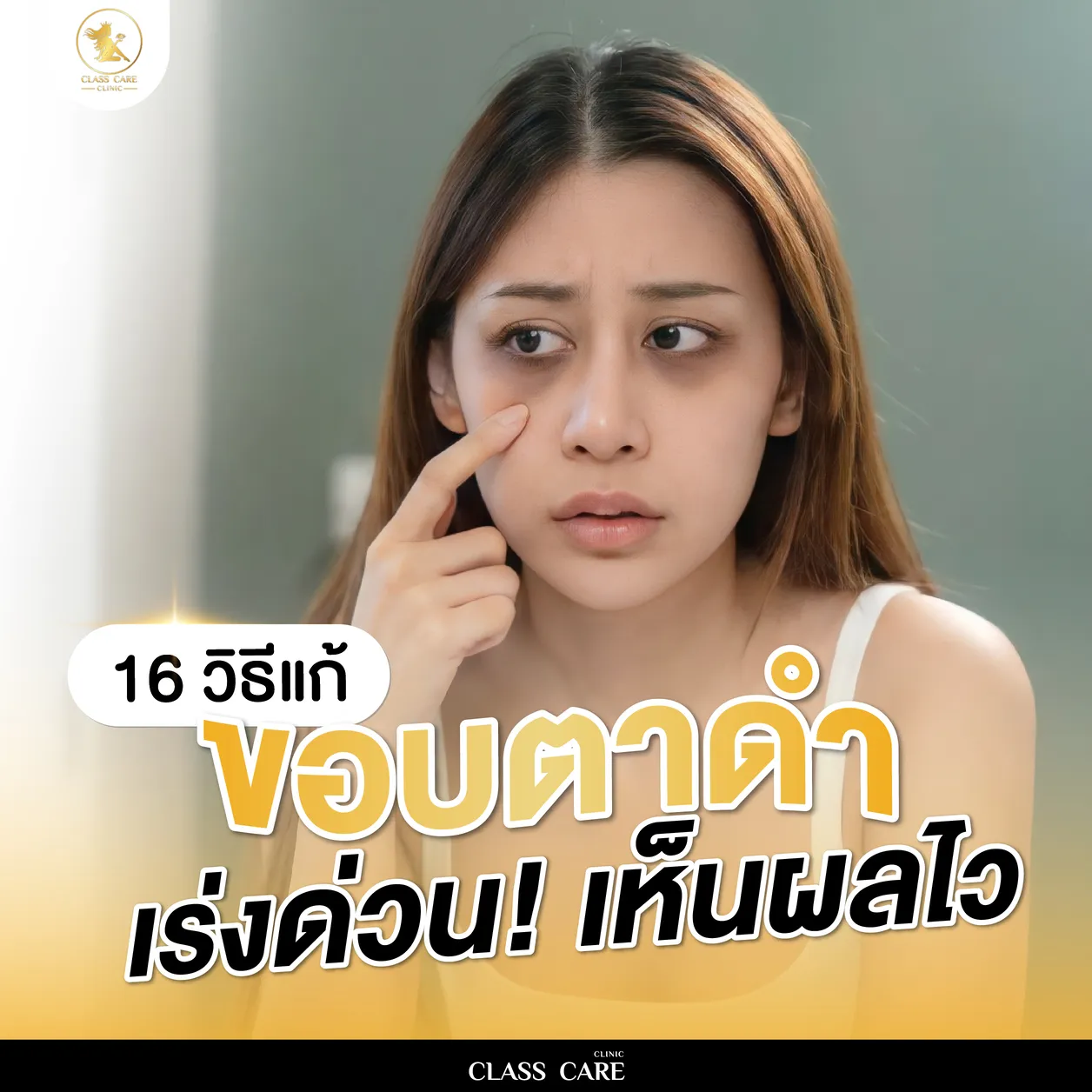 รวม 16 วิธีแก้ขอบตาดำ เร่งด่วน เห็นผลไว