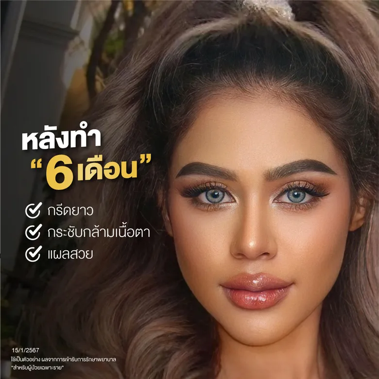 อัปเดตการหายของแผลและการพักฟื้นในแต่ละช่วงเวลา