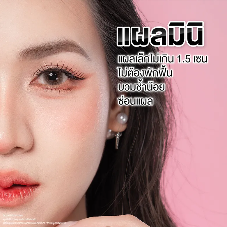 จุดเด่นของเทคนิคแผลมินิ (แผลเล็ก บวมน้อย ไม่ต้องพักฟื้น)