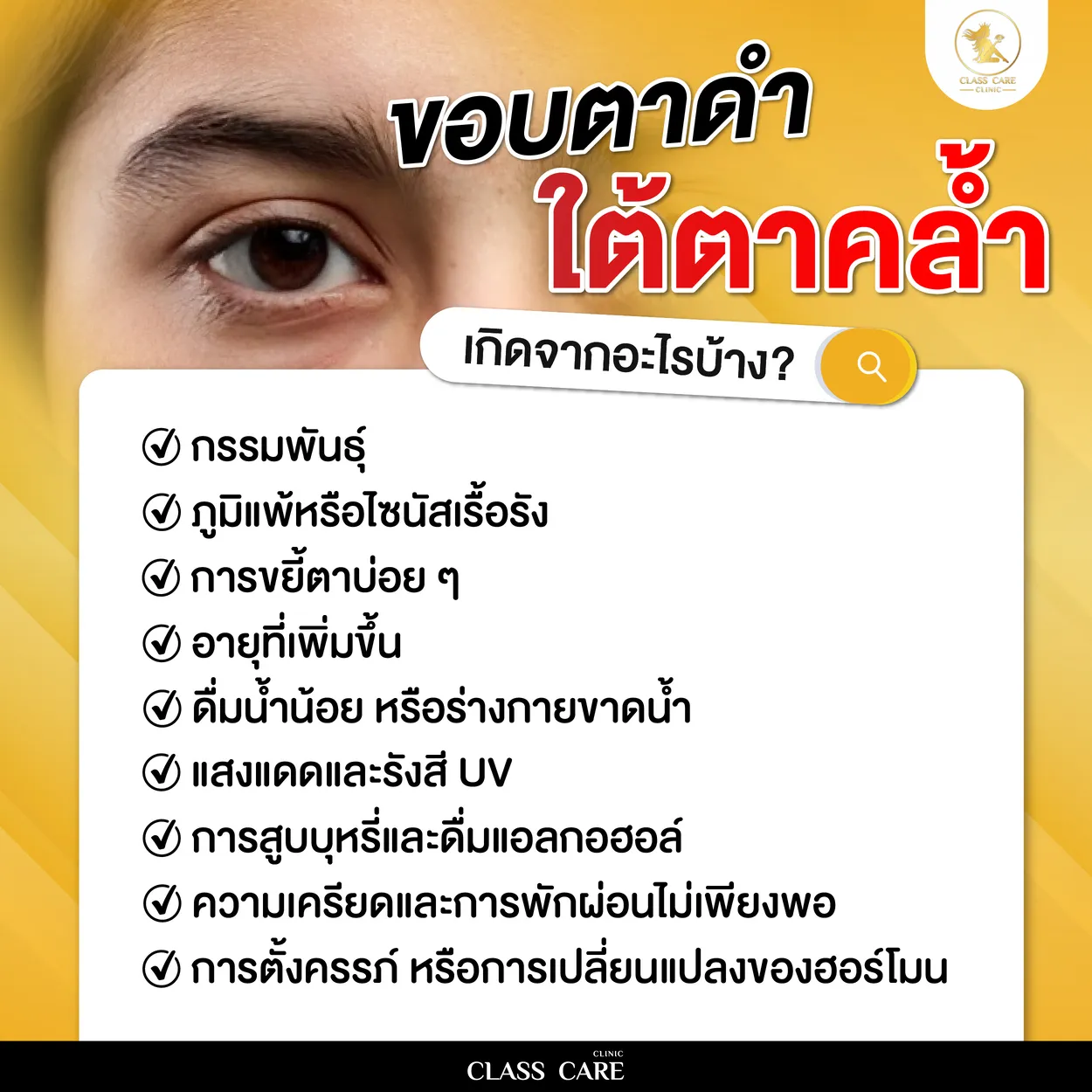 ขอบตาดำ ใต้ตาคล้ำ เกิดจากอะไรบ้าง?
