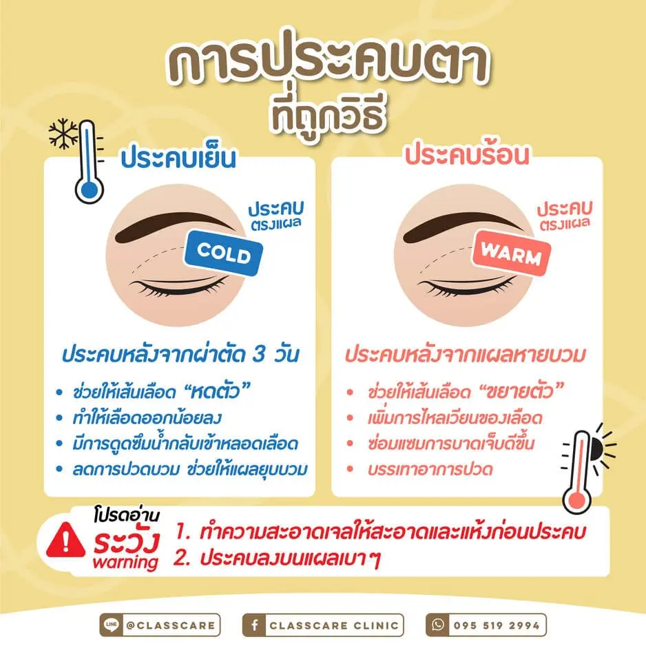 การประคบตาที่ถูกวิธี