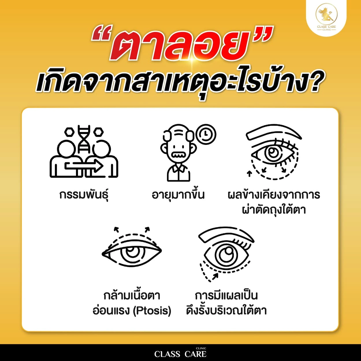 สาเหตุหลักที่ทำให้เกิดลักษณะตาลอย