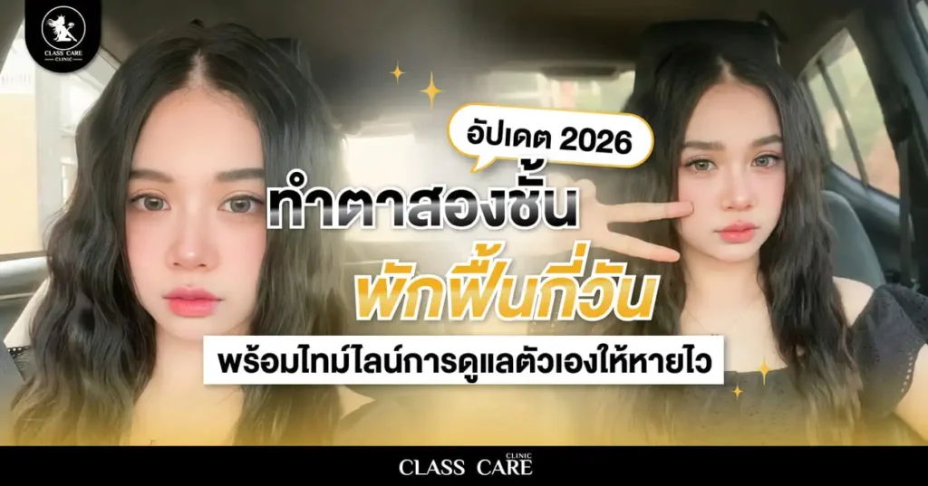 ทำตาสองชั้น พักฟื้นกี่วัน? อัปเดต 2026 ไทม์ไลน์การดูแลตัวเองให้หายไว