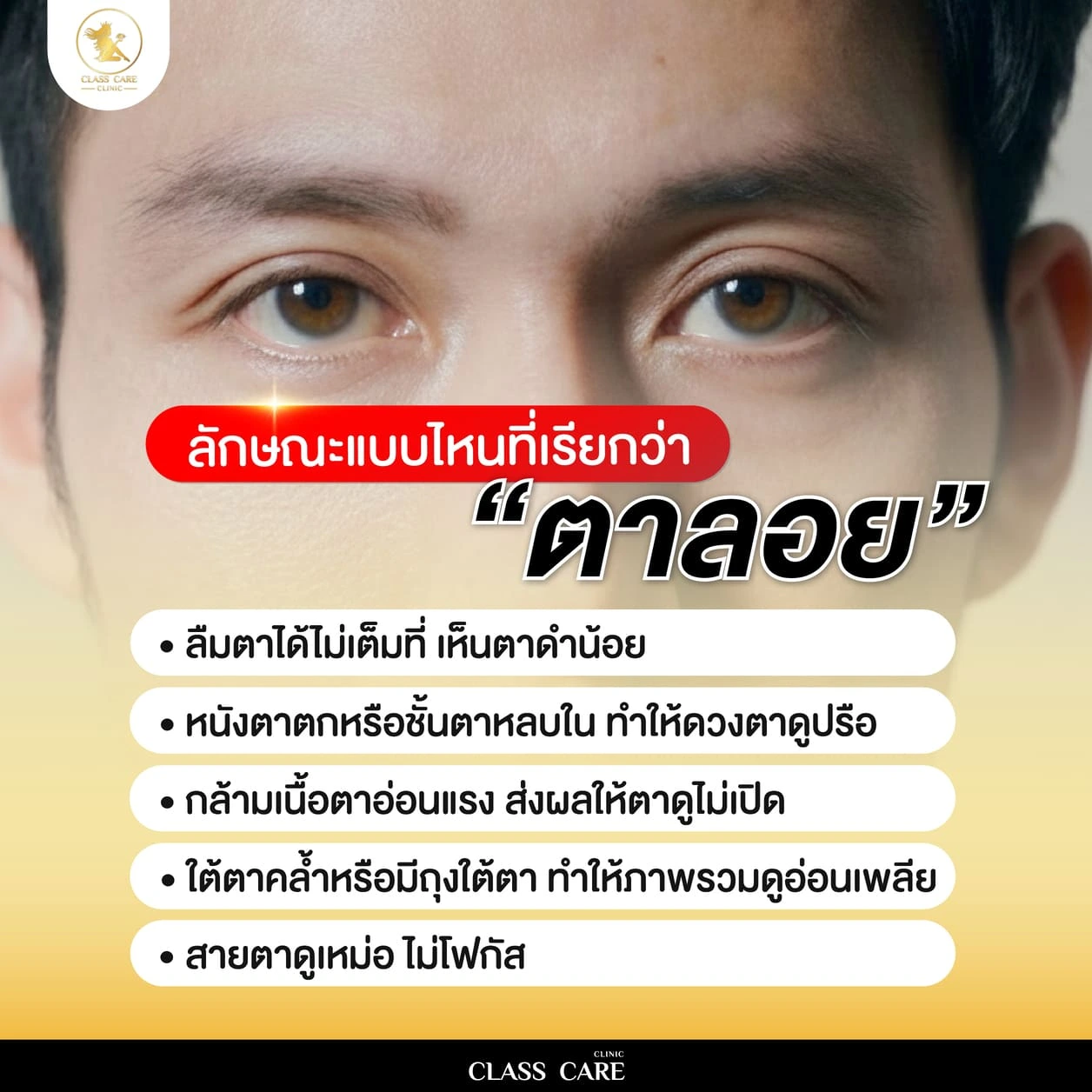 ใครบ้างที่มีปัญหาตาลอยและควรแก้ไข