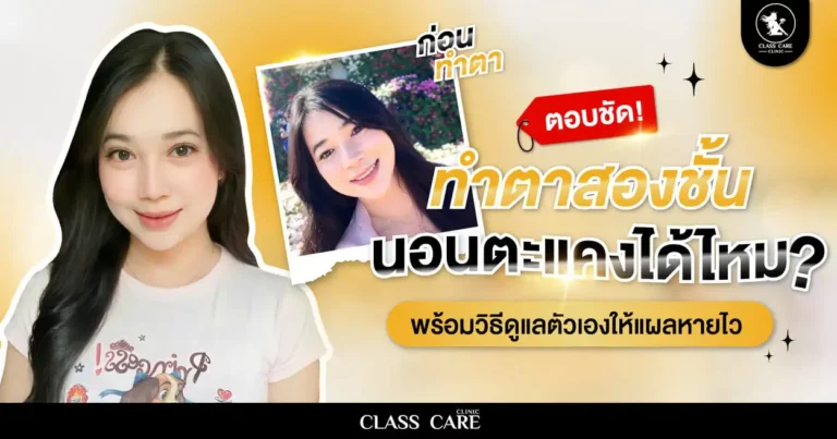 ตอบชัด! ทำตาสองชั้น นอนตะแคงได้ไหม พร้อมวิธีดูแลตัวเองให้แผลหายไว