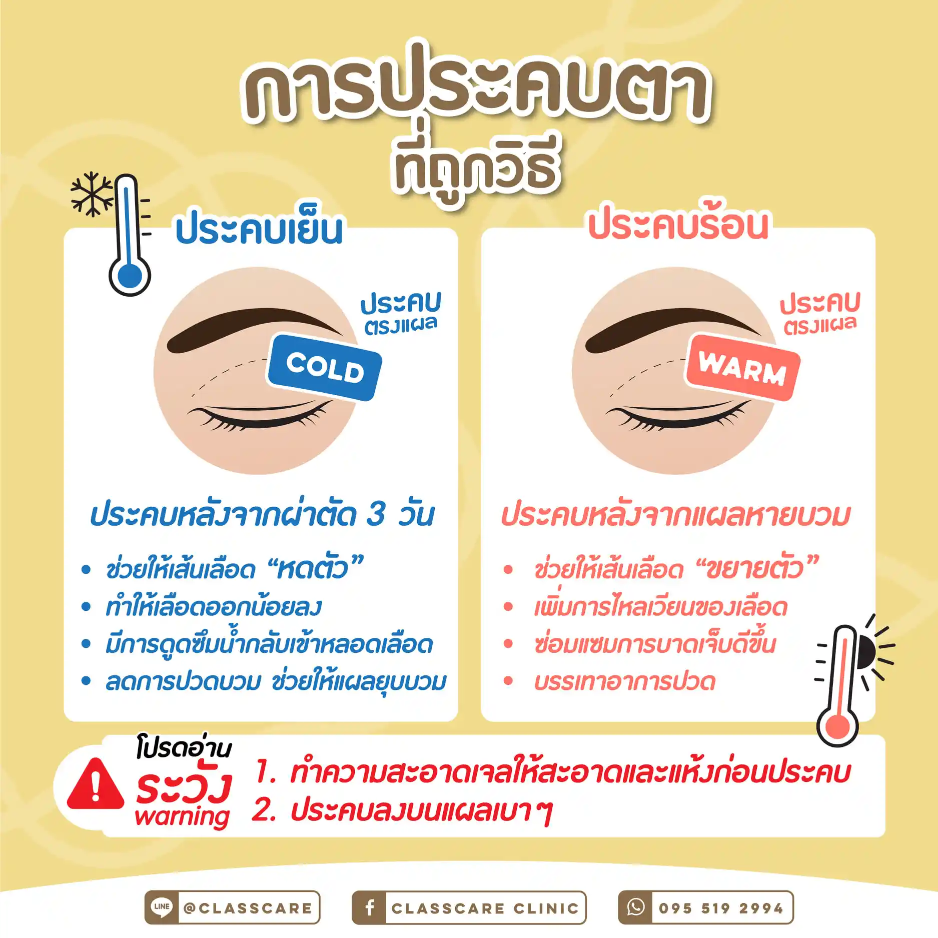 เปรียบเทียบ “ประคบเย็น vs ประคบอุ่น”