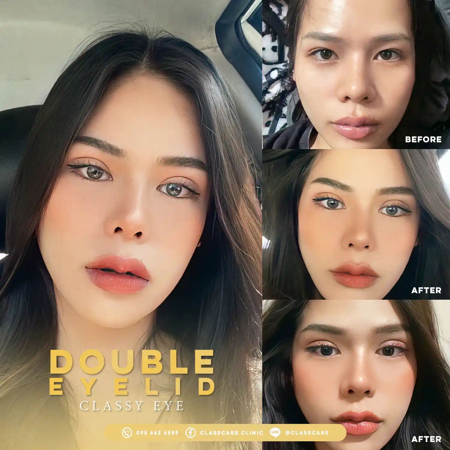 วิธีการทำ Foxy Eyes