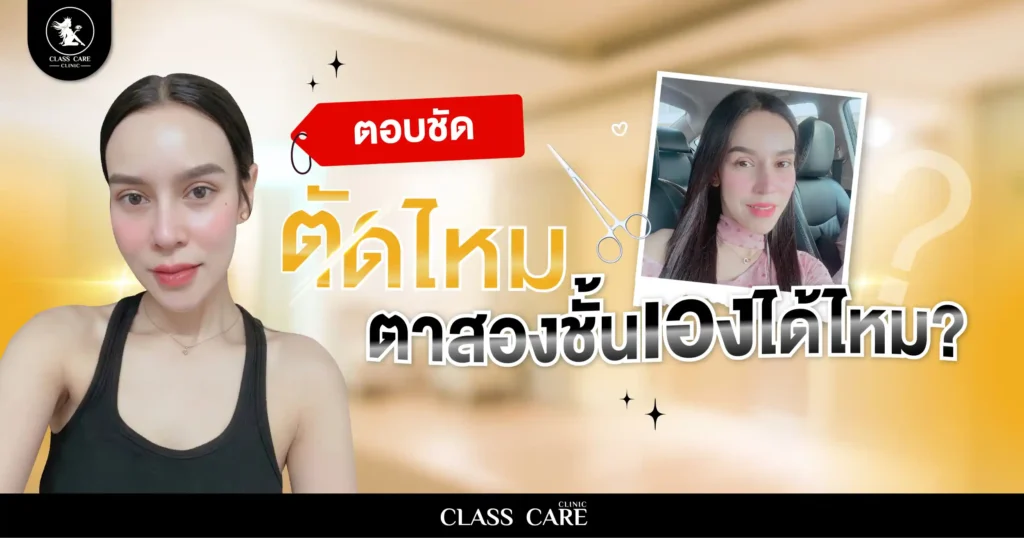 ตอบชัด ตัดไหมตาสองชั้นเองได้ไหมพร้อมวิธีดูแลแผล