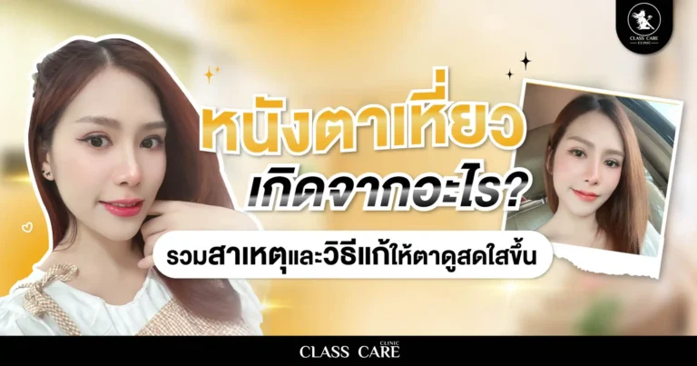 หนังตาเหี่ยวเกิดจากอะไร? รวมสาเหตุและวิธีแก้ให้ตาดูสดใสขึ้น