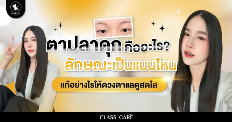 ตาปลาดุกคืออะไร? ลักษณะเป็นแบบไหน และแก้อย่างไรให้ดวงตาดูสดใสขึ้น